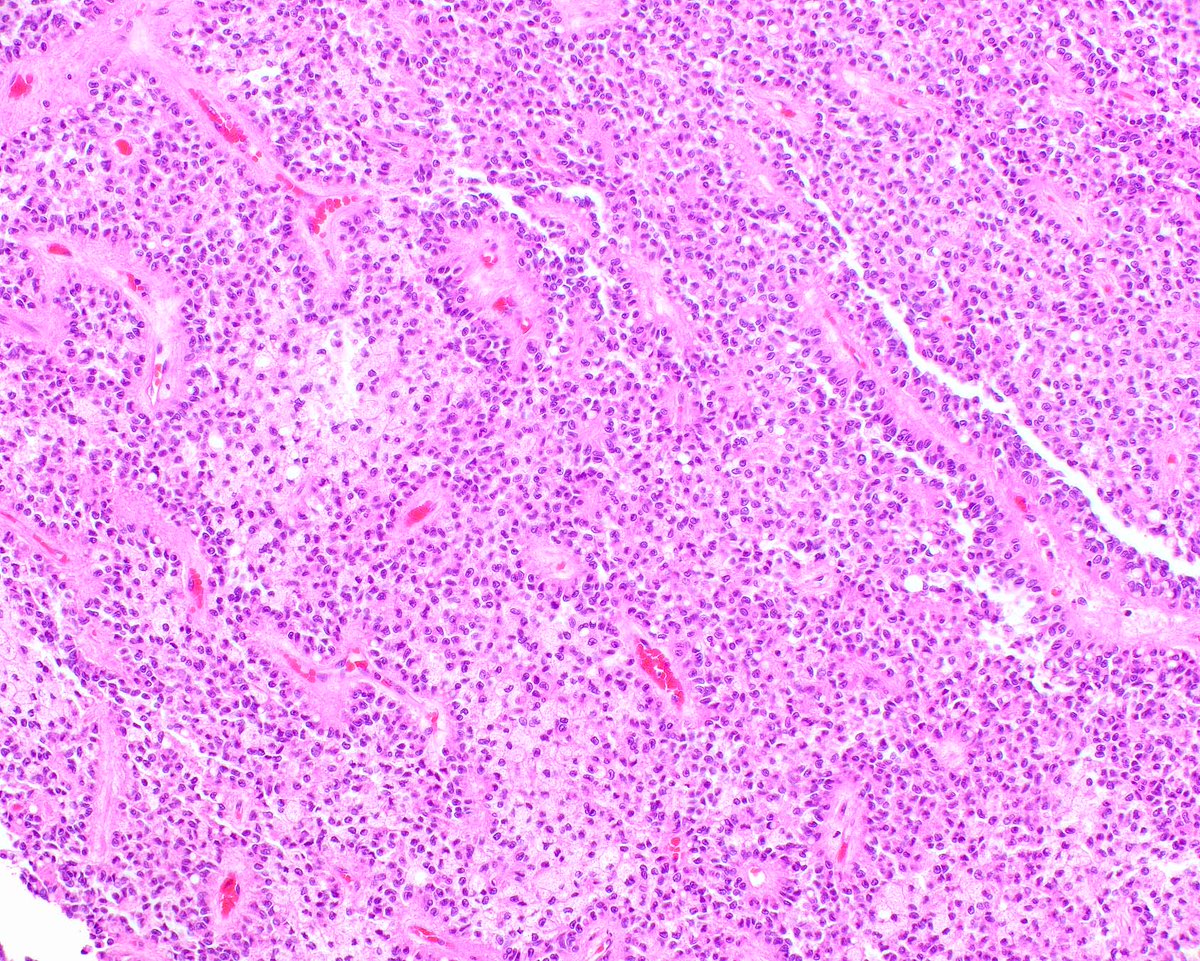 Modern Pathology tweet media