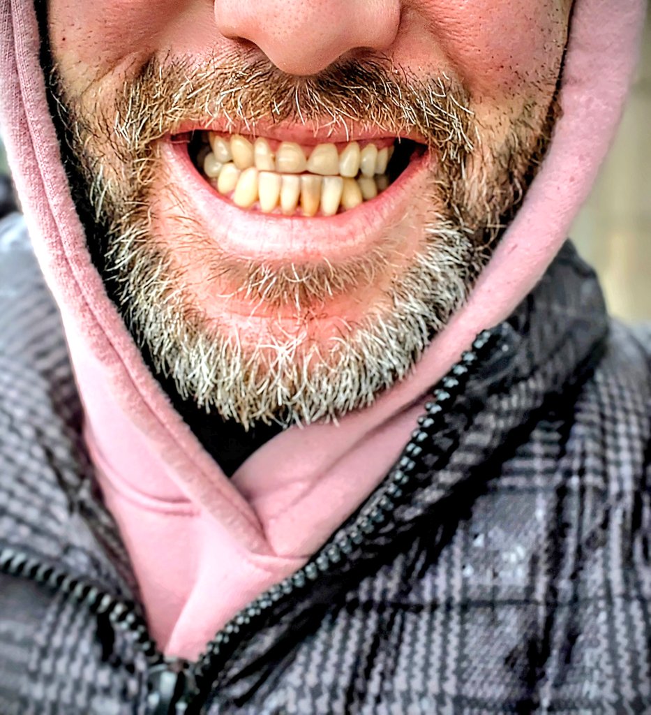 On Saturday a sticky toffee sweet took out my front tooth.
Today a very talented dentist gave me a smile back.

It’s not a Hollywood smile, but it’s a happy one. I’m pleased with it.