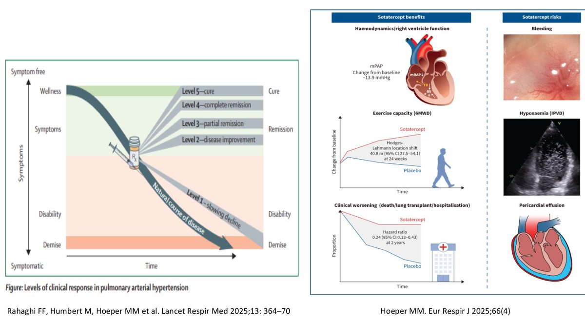 SeguraCardio's tweet photo. Esta tarde en #CardioSpaces con el Dr. @EspildoraNeumo comentaremos la importancia de actuar precozmente en los pacientes Hipertensión Arterial Pulmonar
Os esperamos aquí a las 20h GMT+1
https://t.co/dlVLrGokYL https://t.co/whjynzJpZg