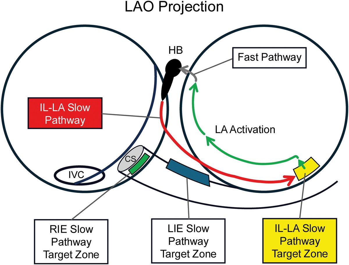 Heart Rhythm Case Reports tweet media
