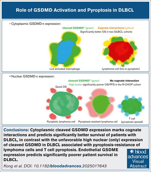 BloodPortfolio's tweet photo. Cytoplasmic cleaved #GSDMD in live activated macrophages and #DLBCL cells marks cognate interactions and predicts better patient survival. Read in Blood Advances: https://t.co/ytKtvAV1yV #BloodAdvances https://t.co/EpxYxf0KdB
