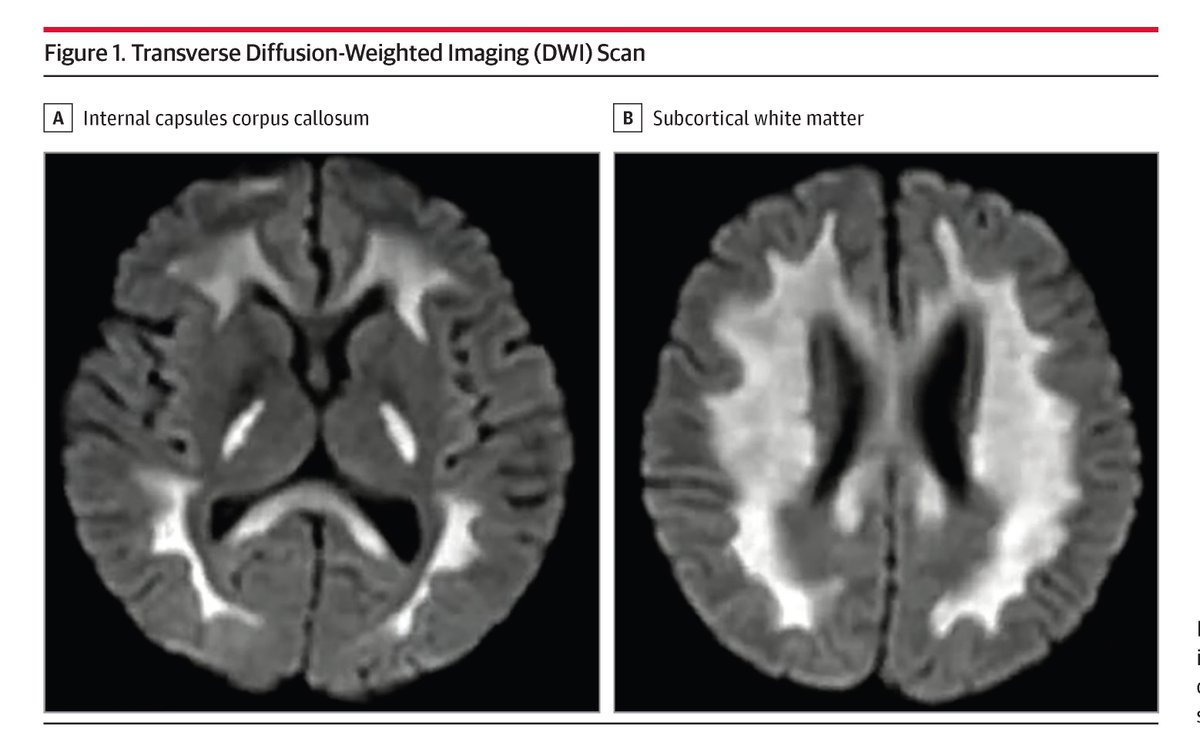 JAMA Neurology tweet media
