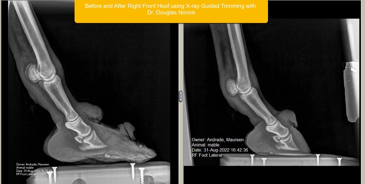 NovickDvm's tweet image. Before &amp;amp; After: Dr. Novick treated a donkey suffering from laminitis (founder). Using X-ray guided trimming, Dr. Douglas was able to evaluate the internal structures of the hoof and guide a precise trim to help improve balance and support. #horses #horsecare #equinecare