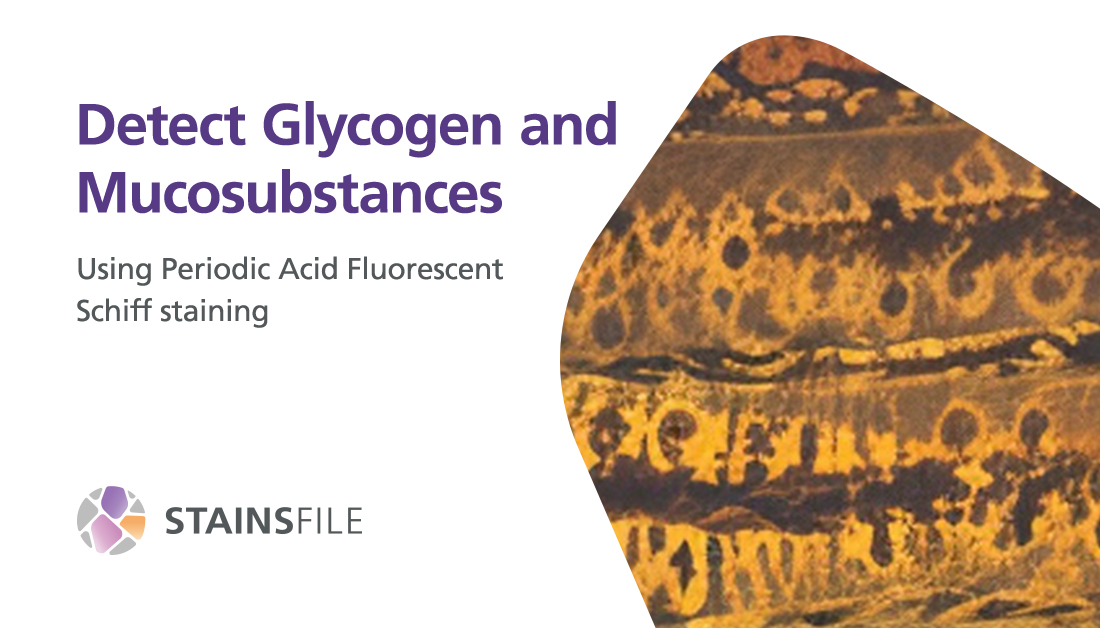 StainsFile tweet media