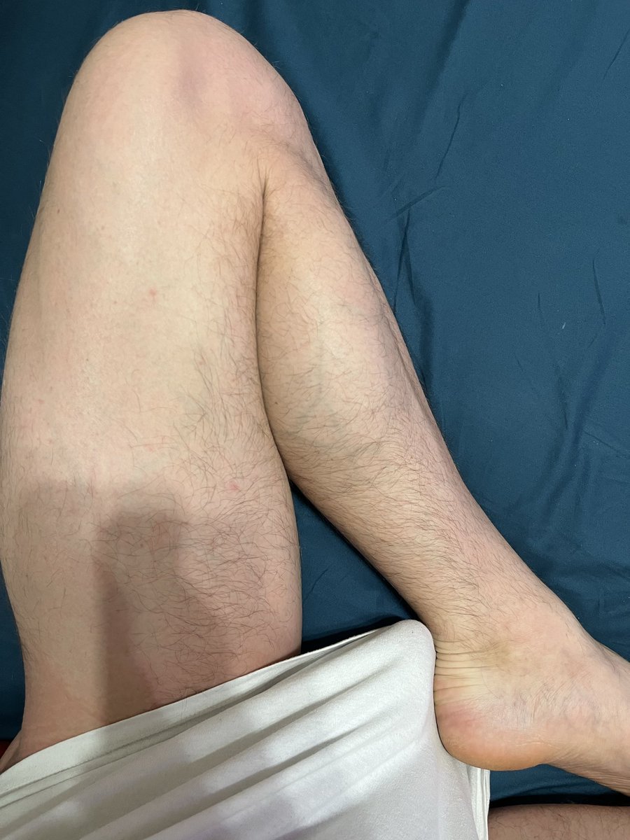 Пан Круасан tweet media