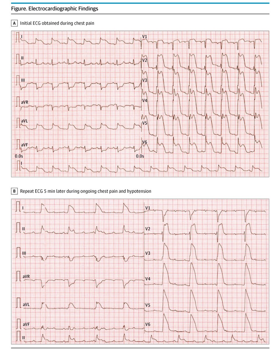 JAMA Internal Medicine tweet media
