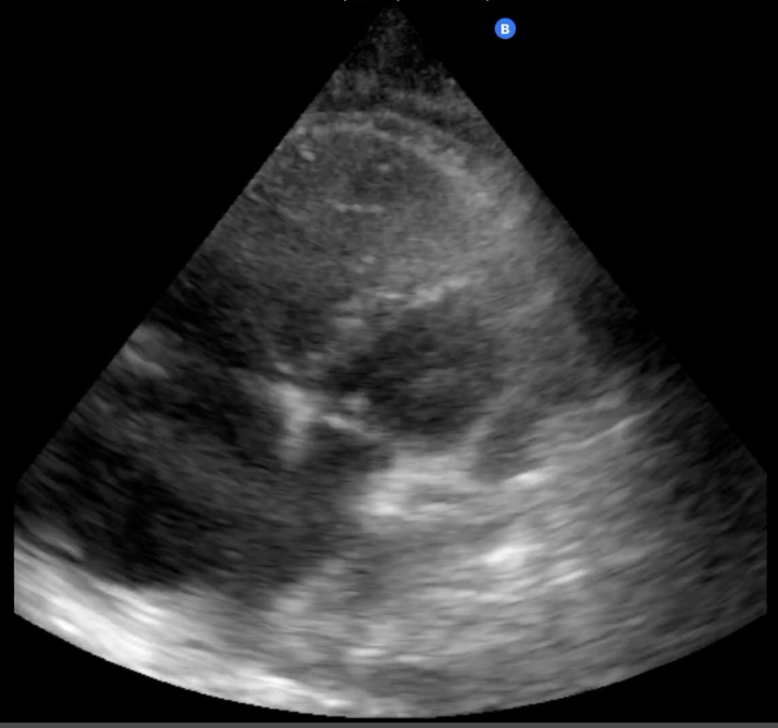 Amos Dodi, MD tweet media