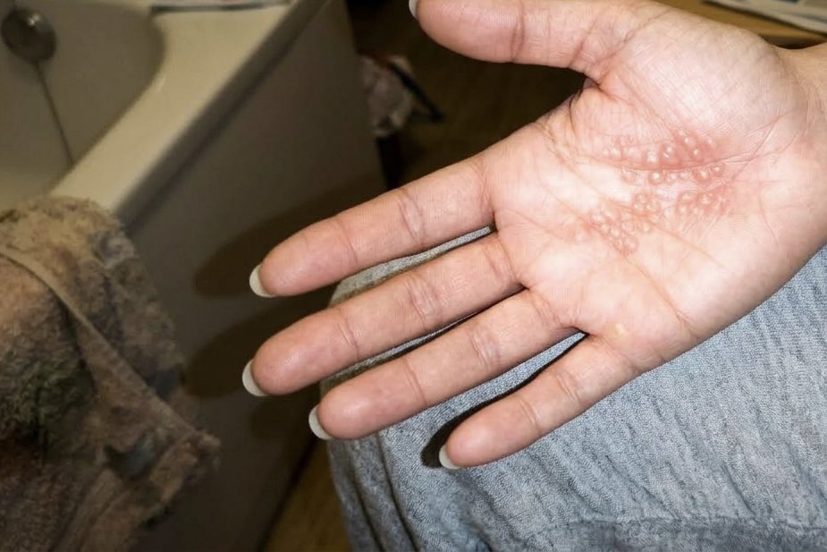 Bayrak Medya tweet media