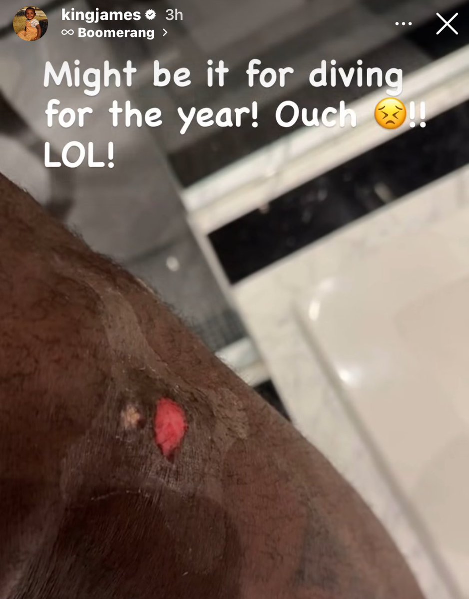 LakeShowYo tweet media