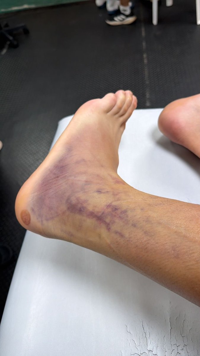 Leandro Adonio Belli tweet media