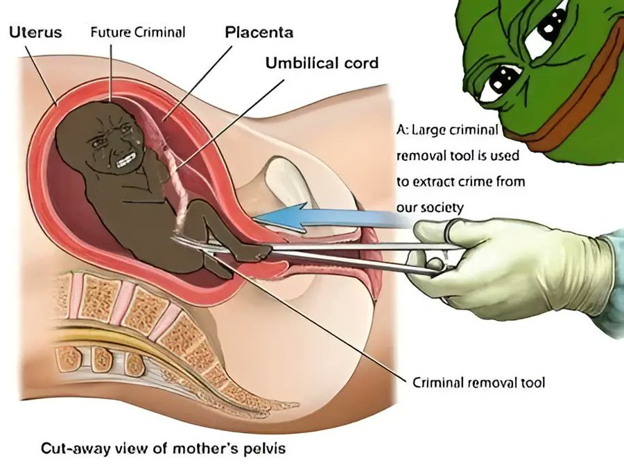 Claire the evil🏳️⚧️卐 tweet media