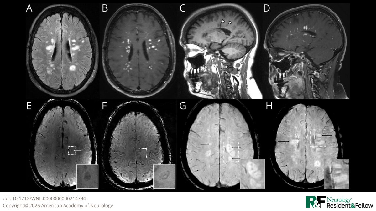 Neurology Journal tweet media