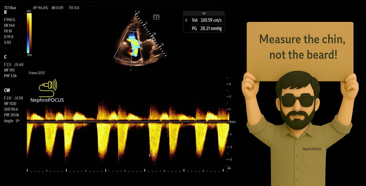 NephroPOCUS tweet media