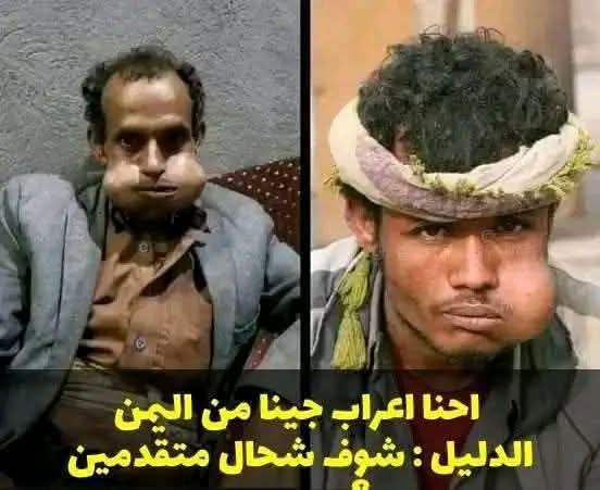 AdamAkdal's tweet photo. استفسار جدي:
وين يتباع القات اليمني في الجزائر؟
راه كاين جماعة هنا يقولو أصلهم من اليمن… قلت نعاونهم يعيشو التقاليد تاع الأجداد كامل، ماشي غير النسب برك. 😏
اللي يعرف بلاصة يدلنا… نخلو الناس ترجع للأصل. https://t.co/OqeHdHNwLm