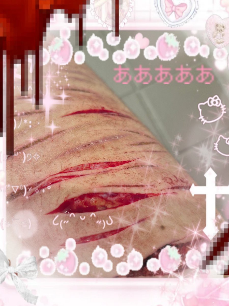 Skittles^_^ tweet media