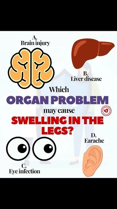 AllScientifical's tweet image. 🦵 Which organ problem may cause swelling in the legs? #swelling #healthproblems #legswelling ... Continue to: youtube.com/watch?v=XKT3rb…