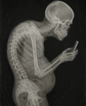 VidaenpositivoX's tweet photo. El cortisol no sólo te produce ansiedad.

Está matando tu testosterona, almacenando grasa abdominal y arruinando tu sueño.

Aquí te mostramos cómo apagar el interruptor del estrés y recuperar tu cerebro 🧵

1. Corrige tu postura. https://t.co/flxxpI0pfH