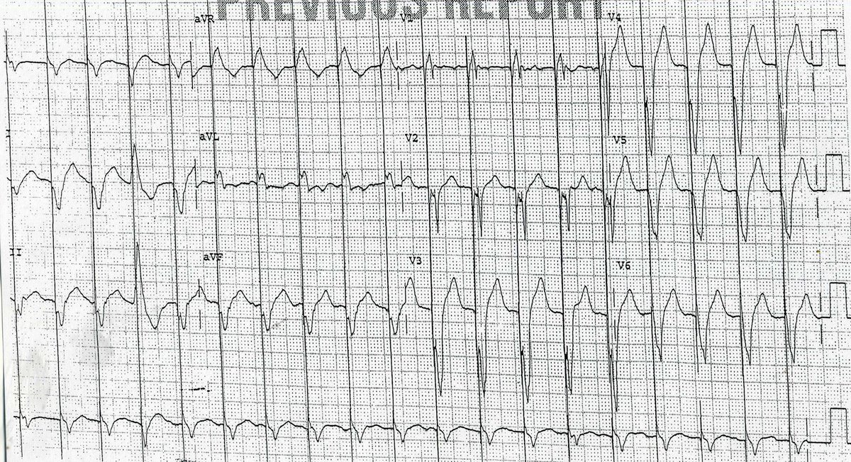 Philip J Podrid MD tweet media