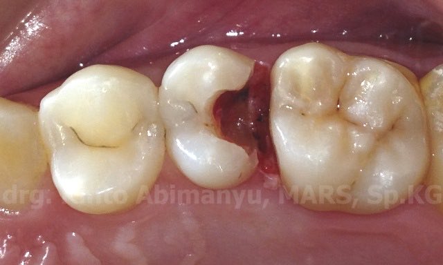 Koas Gigi Jakarta_Zakia tweet media