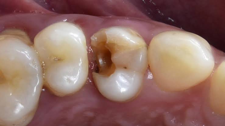 Koas Gigi Jakarta_Zakia tweet media