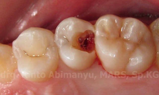 Koas Gigi Jakarta_Zakia tweet media