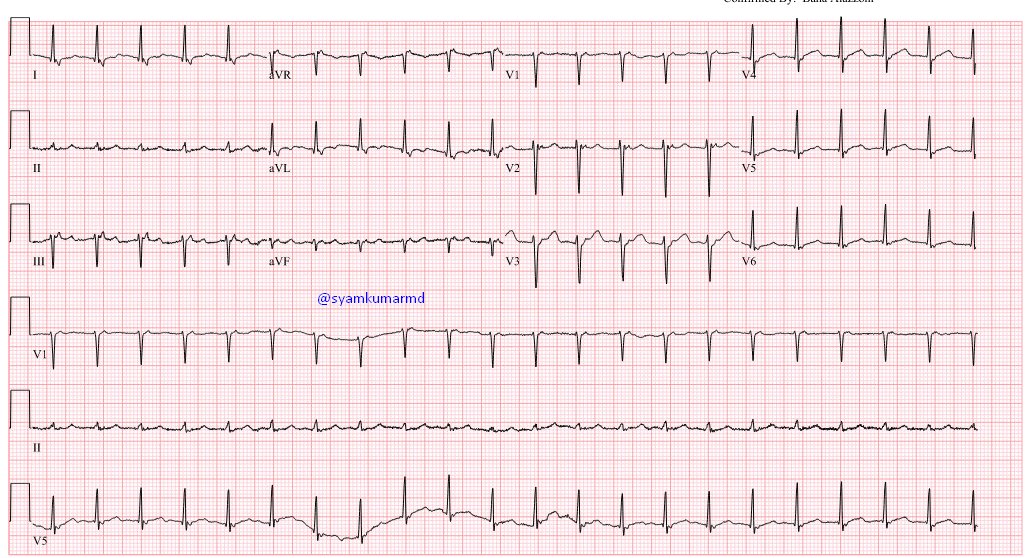 Syamkumar tweet media