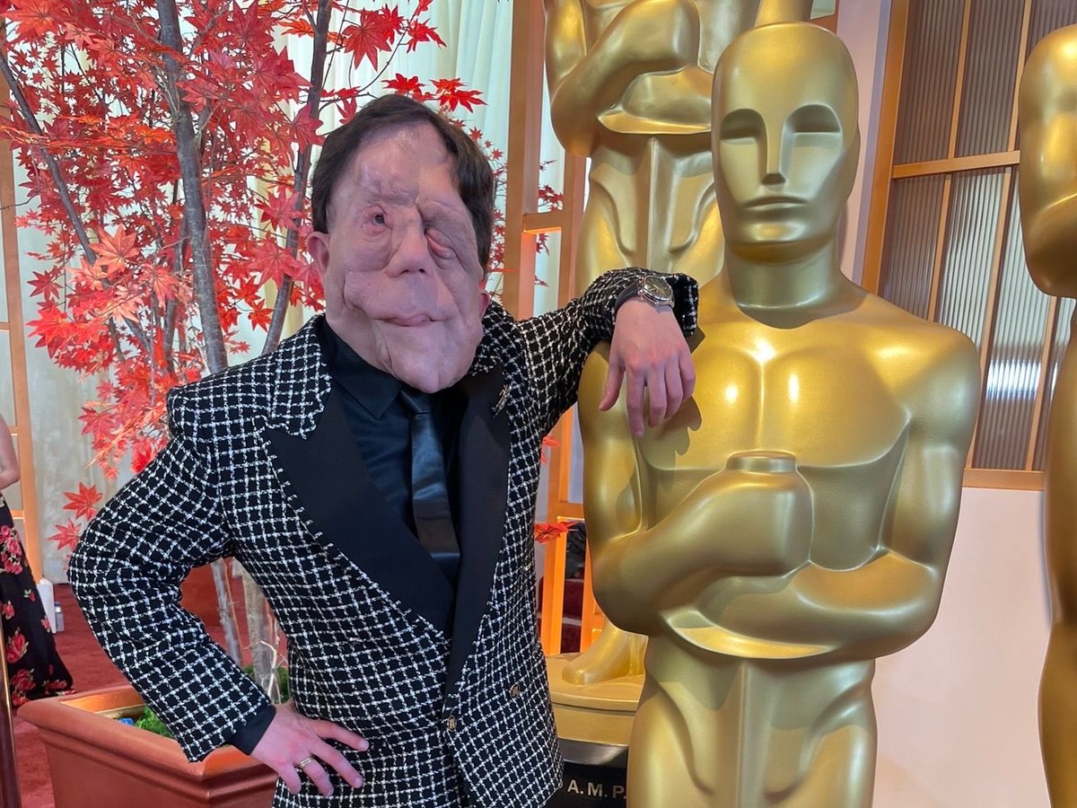 Adam Pearson tweet media