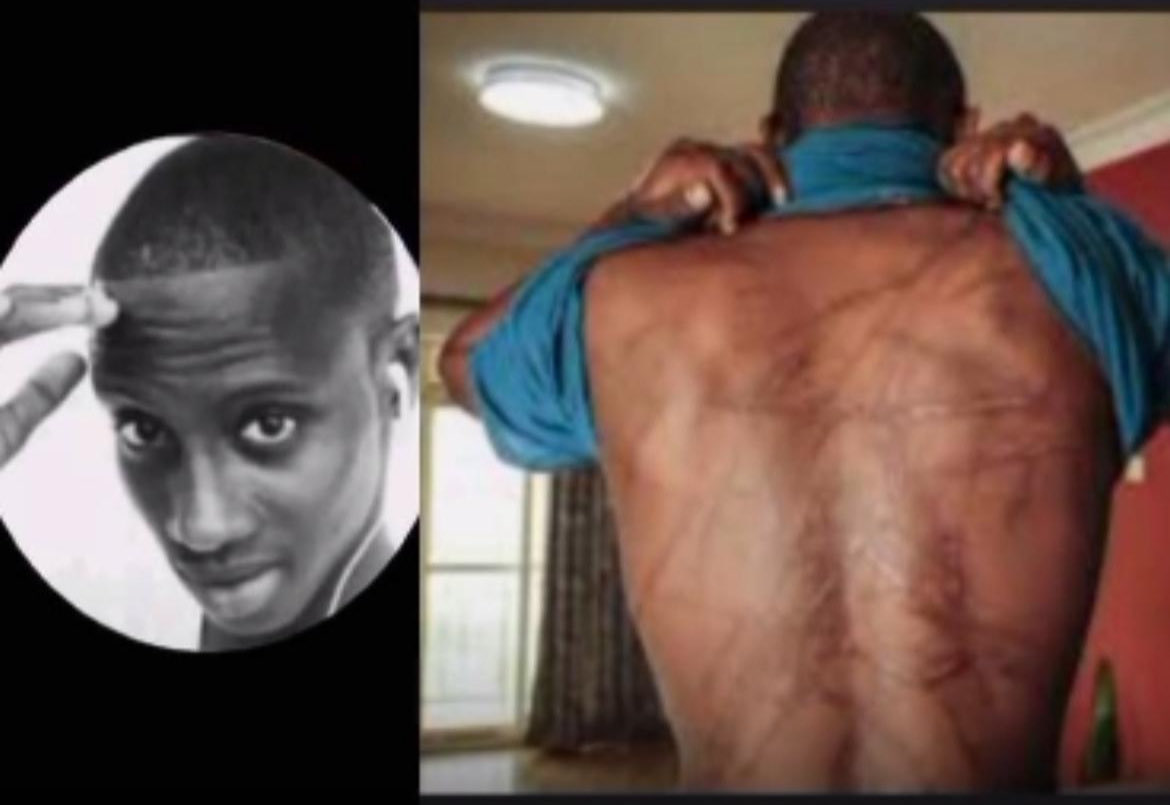 Oumouldial's tweet photo. Voici le témoignage d’une victime de torture sous le régime de Macky Sall. Cet homme est directement lié à des crimes qui choquent la conscience humaine. Ceux qui commettent ou ferment les yeux sur de tels abus n’ont aucune légitimité à prétendre à la tête de l’ONU. Le monde doit voir la vérité.
#HumanRights #No2Macky 
@UN @UNHumanRights @hrw @amnesty @POTUS @SenSanders @SFRCdems @HouseForeign 

https://t.co/2LShIMOVAL
