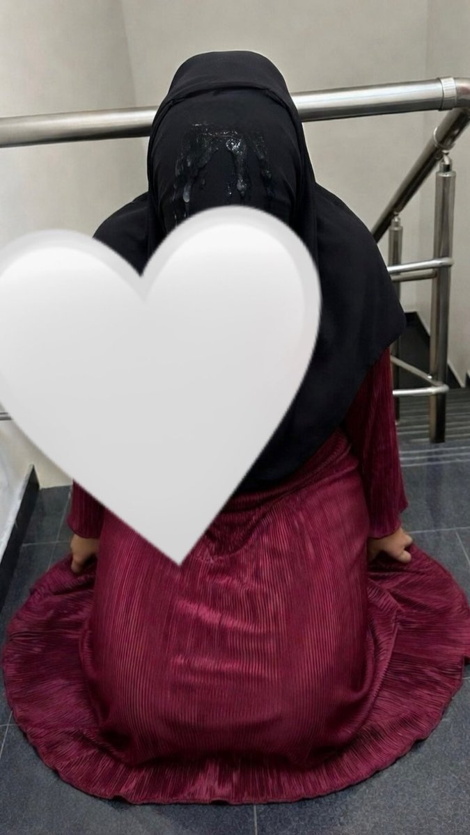 Cruella 🍇 tweet media