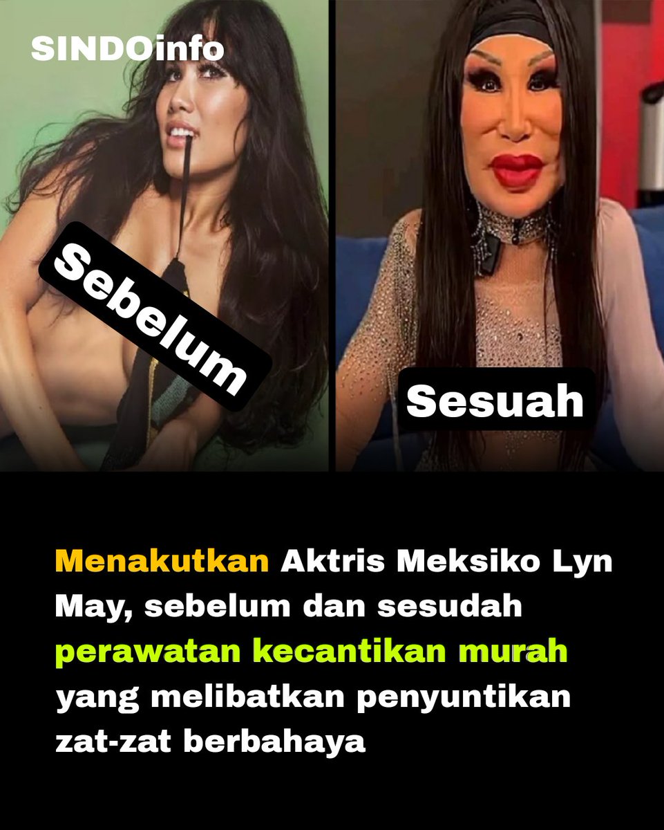 sindoinfo's tweet photo. Oplas gagal malah jadi kelihatan menakutkan, padahal aslinya udah cantik https://t.co/PJwBdVjwKq