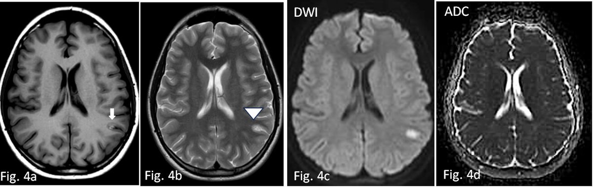 Revista de Neurología tweet media