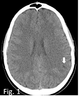 Revista de Neurología tweet media