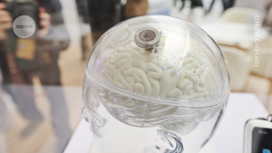 aparanjape's tweet photo. China has approved a brain implant for people with severe paralysis to help restore their hand movements. The brain–computer interface (BCI) is the first in the world to be available for wider use outside of clinical trials.

https://t.co/7jignQwPii

"The device, developed by Neuracle Medical Technology in Shanghai, China, was authorized last week by the National Medical Products Administration. It will be available to people aged between 18 and 60 years old who have paralysis that affects all of their limbs and is caused by an injury to the neck area of the spinal cord.

BCI technology is important because there are no effective ways to treat people who have spinal-cord injuries, says Chen Liang, a neurosurgeon at Huashan Hospital at Fudan University in Shanghai, who was involved in the clinical trials of the device, called NEO.

The approval is a milestone for the whole field of BCI research, says Zhengwu Liu, an electrical engineer at the University of Hong Kong who has collaborated with the NEO team."
