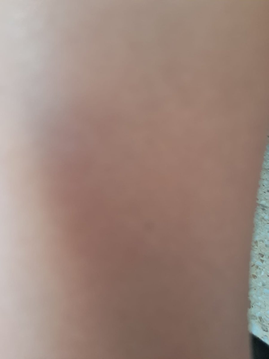 🇺🇸🇺🇸⚡⚡✝️☦️🇻🇦Fatigued Groypercel🇻🇦☦️✝️⚡⚡🐸 tweet media