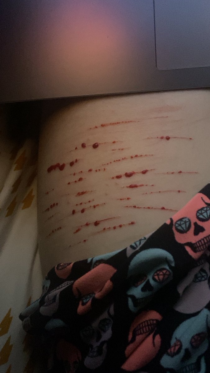 _diviniity's tweet photo. Scared of pain rn ig

#shtwt #cutspo https://t.co/vKAs7JwEQD