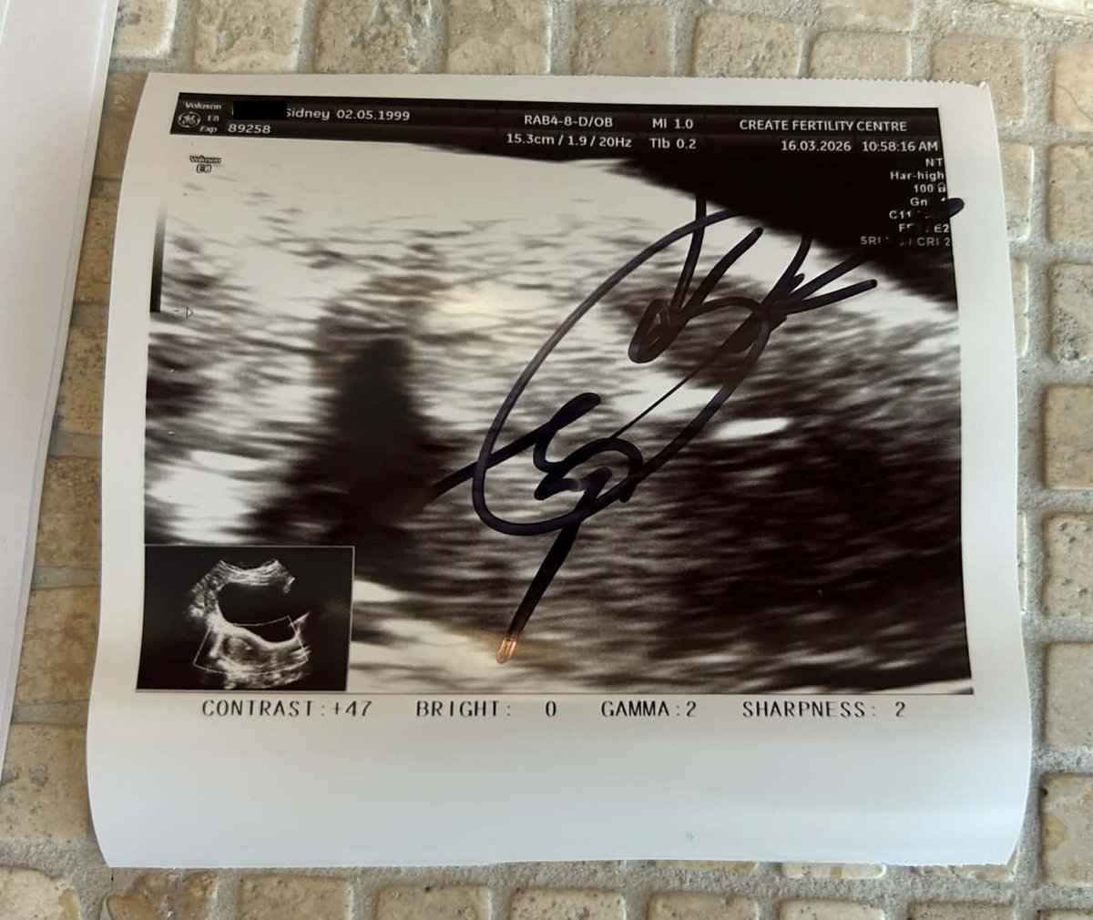 Surrogacy in Canada Online tweet media