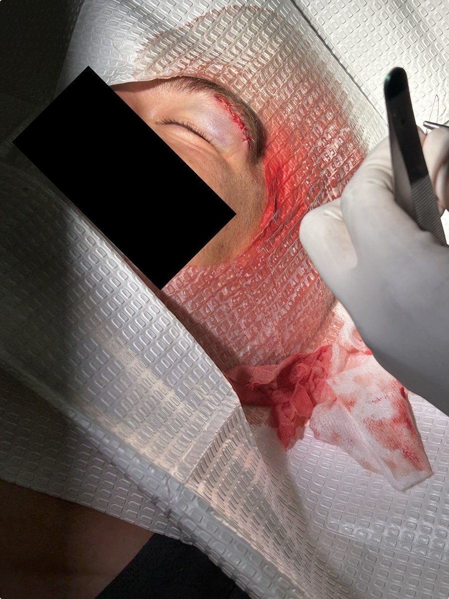 OverThinker tweet media