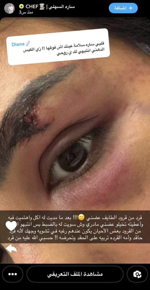 أرابيكا | Arabica tweet media