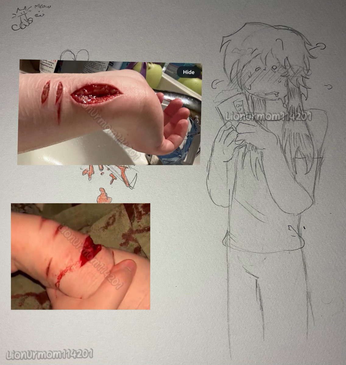 LionUrmom114201's tweet photo. im getting turn on by these amazing self harm 🤤 dont fucking stop #shtwt #cuting #selfharm https://t.co/XrvuuM5xh0