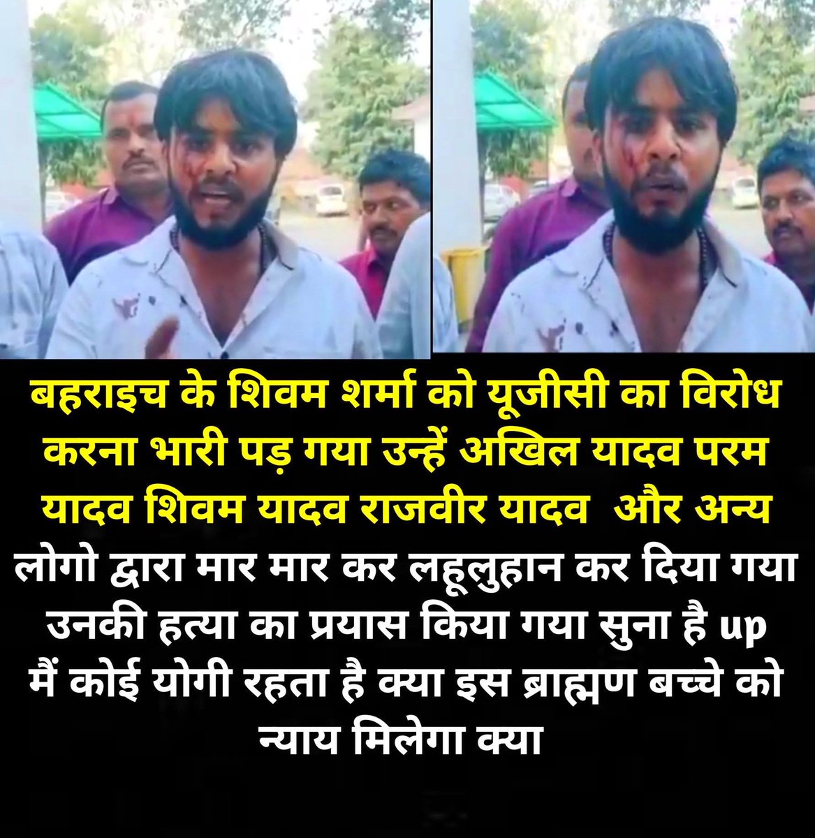 बहराइच के शिवम शर्मा को यूजीसी का विरोध करना भारी पड़ गया उन्हें अखिल यादव परम यादव शिवम यादव राजवीर यादव  और अन्य लोगो द्वारा मार मार कर लहूलुहान कर दिया गया उनकी हत्या का प्रयास किया गया सुना है up मैं कोई योगी रहता है क्या इस ब्राह्मण बच्चे को न्याय मिलेगा क्या