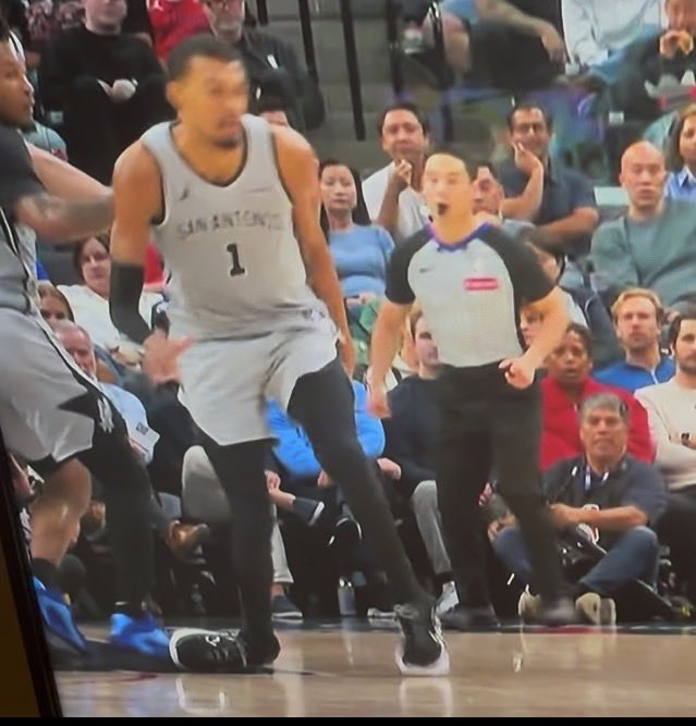 Look at Wemby's ankle. 

Playing through this like it's nothing is another proof that life outside the Earth exists.
