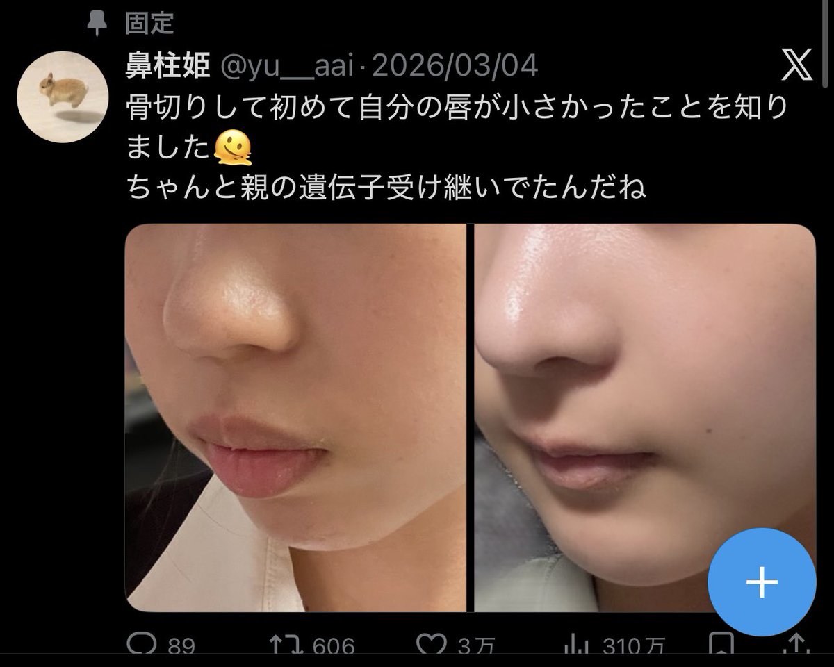 鼻柱姫 tweet media