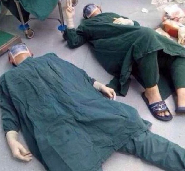 These doctors collapsed after 28 hours surgery of separating my relatives nose from my personal matters