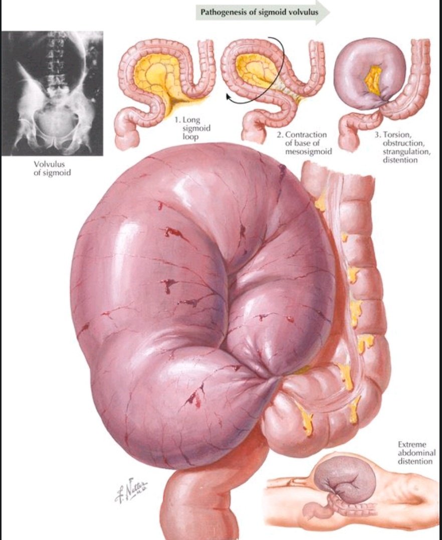 الترياق الشافي 🥣 tweet media