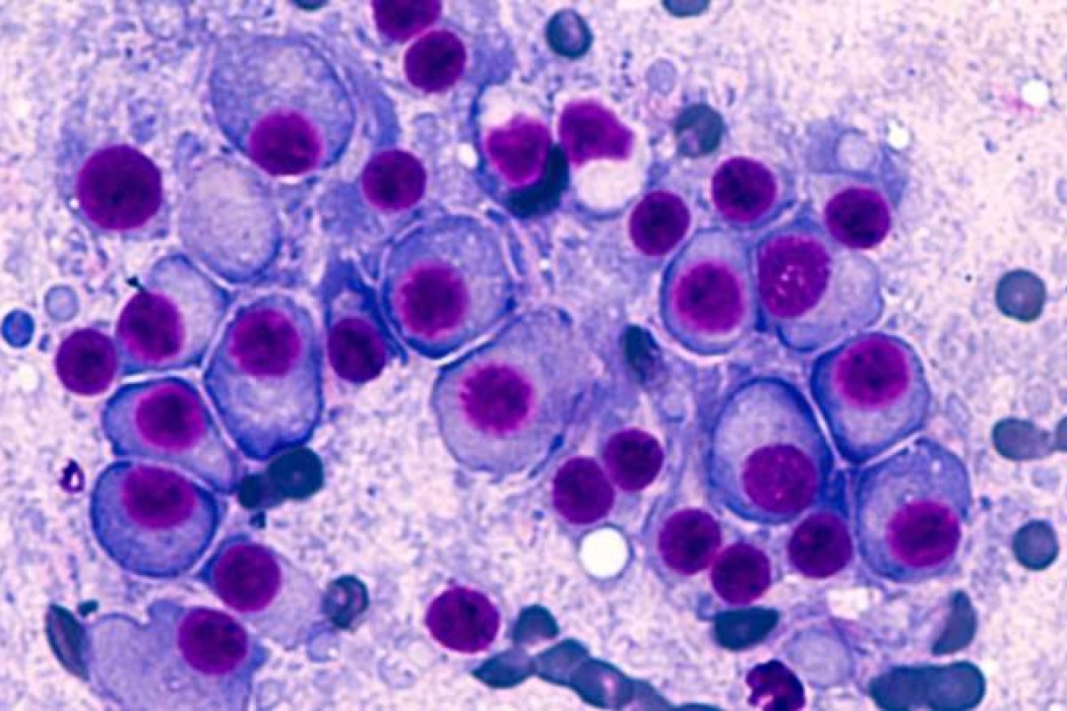 Drug Discovery World tweet media