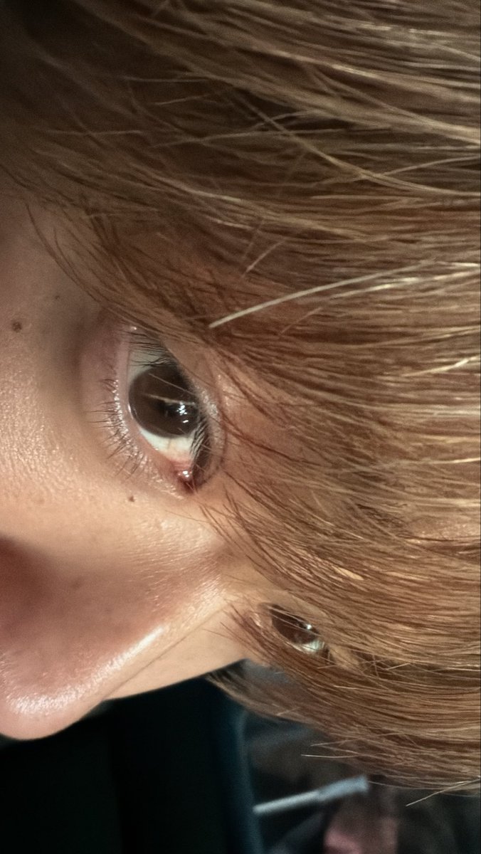 やまにむ(公式) tweet media