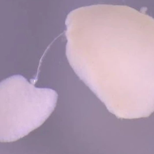 Instituto de Salud Carlos III (ISCIII) tweet media