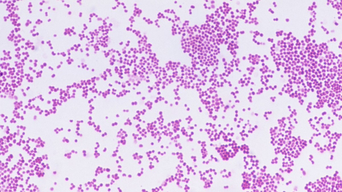 Strain Of Meningitis In Kent Confirmed As Meningitis B AKA Bacterial Meningitis