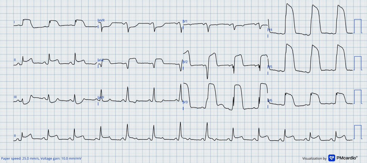 Dr J NELSON OKEMA, MD 🇬🇧 tweet media