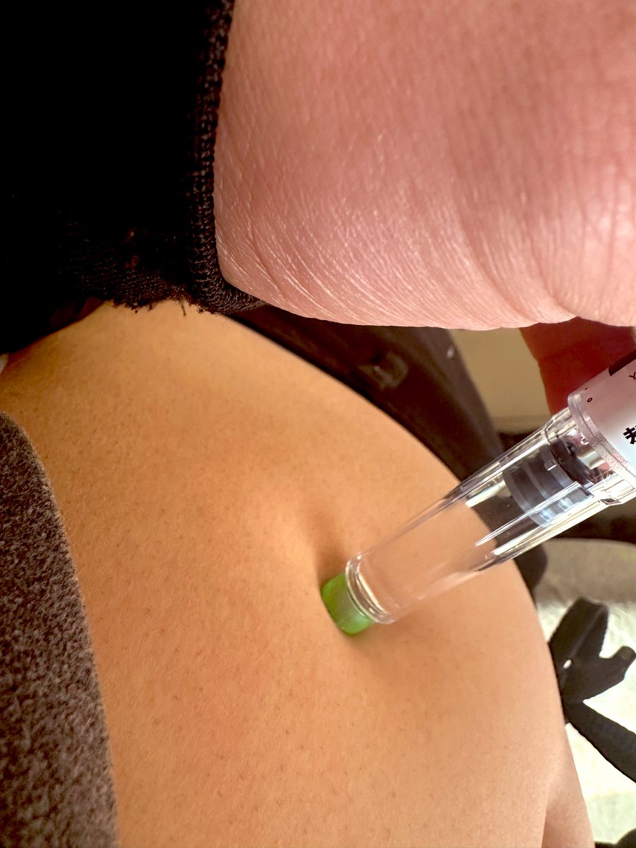 Polo1.4 贱🕊️ tweet media